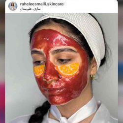 فیشال و پاکسازی پوست راحله اسماعیلی ساری