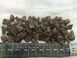 دکتر نادعلی موسی نژاد متخصص کلیه ساری