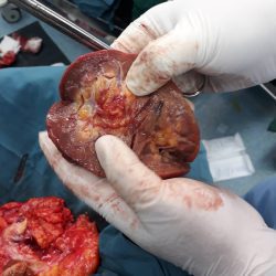 بهترین دکتر فوق تخصص کلیه در ساری