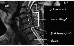 اینستاگرام فیزیوتراپی مداوا ساری