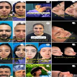 اینستاگرم دکتر محمد توکلی جراح بینی ساری