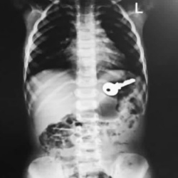 متخصص کودکان ساری دکتر سیدعبداله موسوی