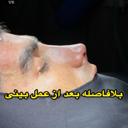 دکتر محمد توکلی جراح بینی ساری