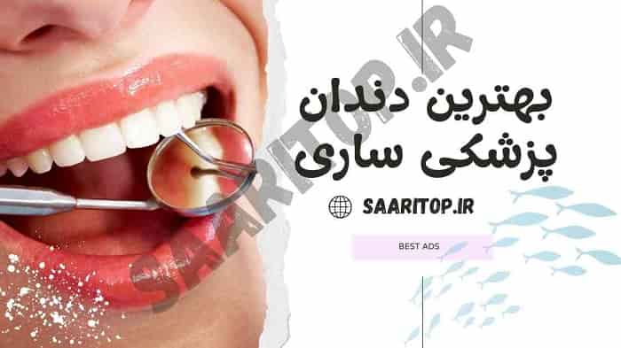 بهترین دندان پزشکی ساری
