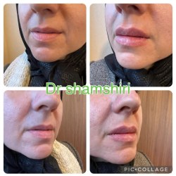 بهترین دکتر پوست ساری