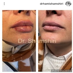 اینستاگرام دکتر حامی شمشیری دکتر پوست ساری