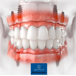 بهترین دندان پزشک ساری
