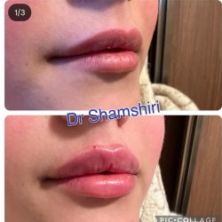 کتر حامی شمشیری دکتر پوست ساری