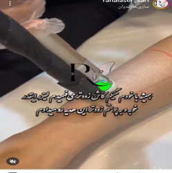 کلینیک لیزر رها ساری