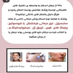 مزونیدلینگ صدف ساری