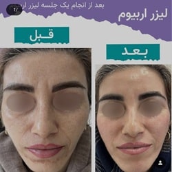 اینستاگرام مزونیدلینگ باران ساری