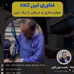 بهترین مزونیدلینگ ساری