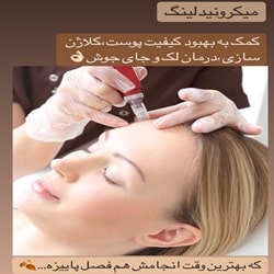 مزونیدلینگ سبز ساری