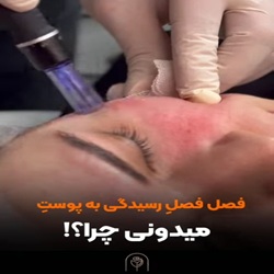 بهترین مزونیدلینگ ساری