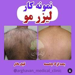 کلینیک لیزر ارغوان بابل