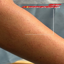 کلینیک لیزر مهر | بهترین کلینیک لیزر بابل