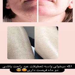 لیزر سینوهه بابل