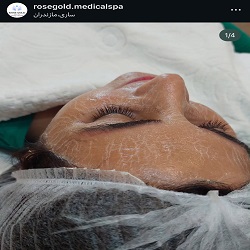 مزونیدلینگ رزگلد ساری