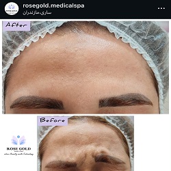 اینستاگرام مزونیدلینگ رزگلد ساری