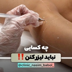 بهترین کلینیک لیزر بابل