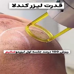 بهترین کلینیک لیزر بابل